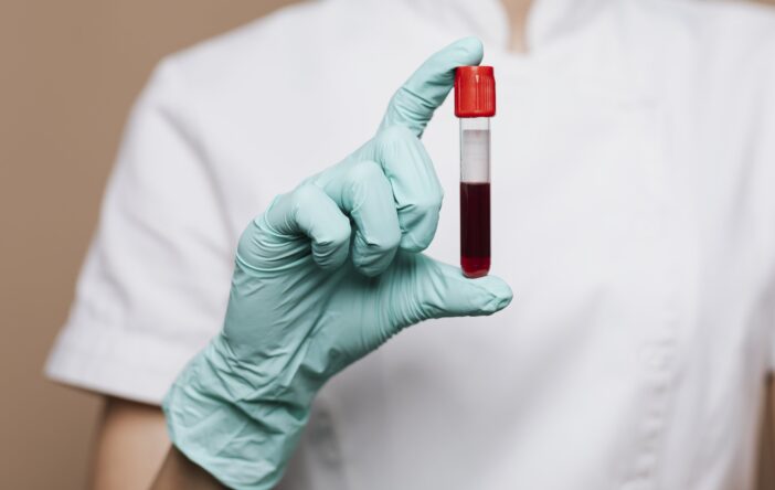 Jak przygotować się do badania krwi? Praktyczne wskazówki przed wizytą w laboratorium