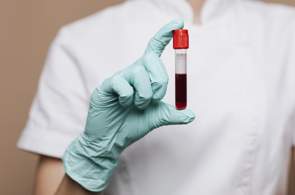 Jak przygotować się do badania krwi? Praktyczne wskazówki przed wizytą w laboratorium